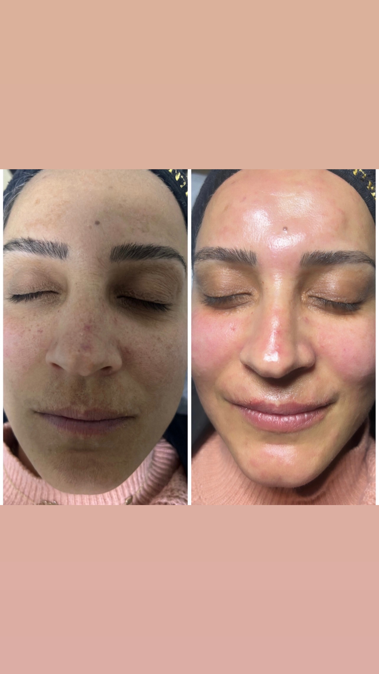 Esma Gülhan beauty güzellik salonu
