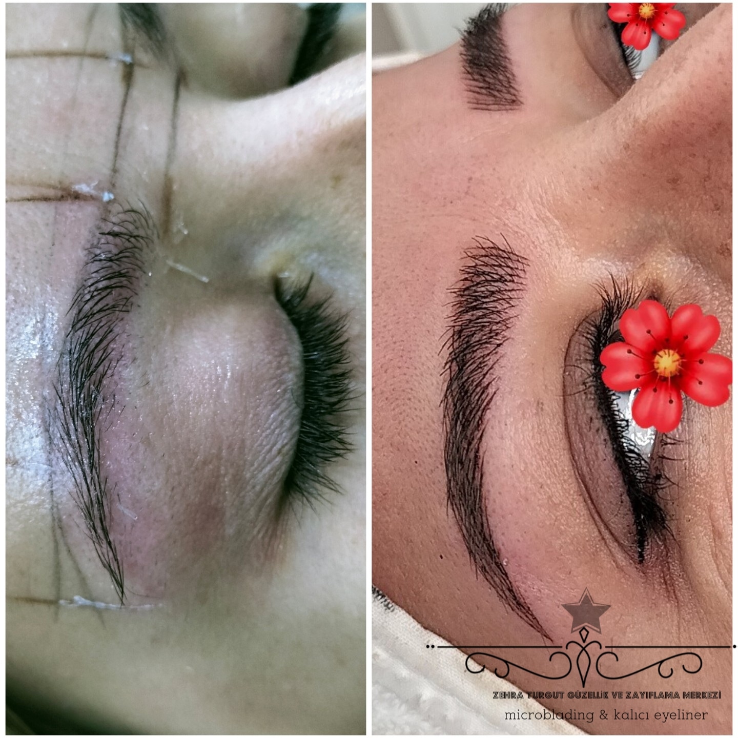 ZEHRA TURGUT GÜZELLİK VE ZAYIFLAMA SALONU